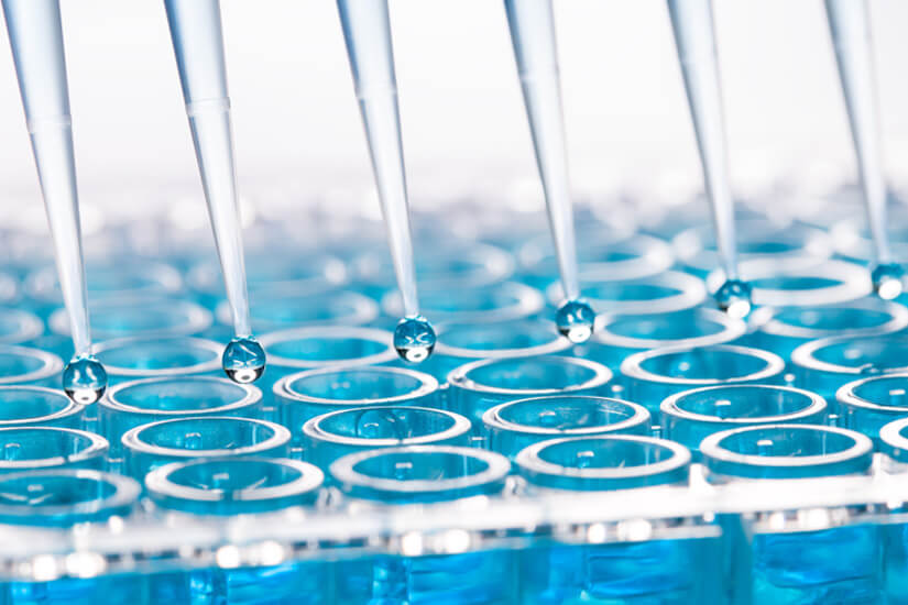 Microvalves for in vitro diagnostics Microvalves for in vitro diagnostics